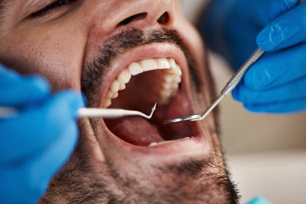Best Cosmetic Dentistry  in Frackville, PA